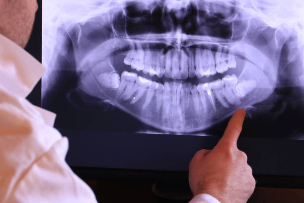 Best Emergency Tooth Extraction in Franklin, PA
