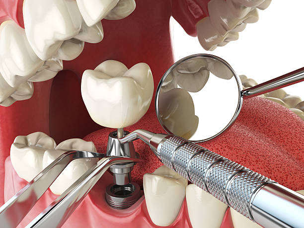 Best Weekend Emergency Dentist in Franklin, PA